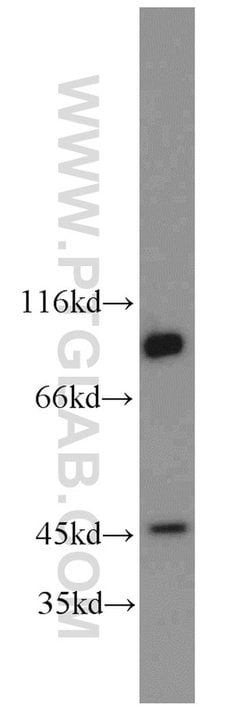 PGAP1 Rabbit anti-Human, Mouse, Polyclonal, Proteintech:Antibodies:Primary