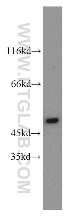 PGAP1 Rabbit anti-Human, Mouse, Polyclonal, Proteintech:Antibodies:Primary