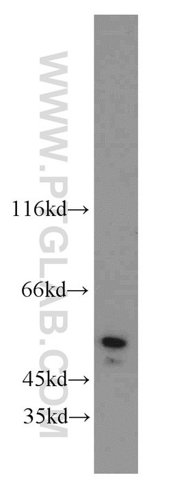 PGAP1 Rabbit anti-Human, Mouse, Polyclonal, Proteintech:Antibodies:Primary