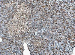 S3-12 Rabbit anti-Human, Polyclonal, Proteintech:Antibodies:Primary Antibodies