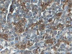 S3-12 Rabbit anti-Human, Polyclonal, Proteintech:Antibodies:Primary Antibodies