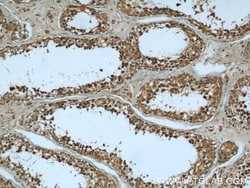 KHSRP Rabbit anti-Human, Mouse, Rat, Polyclonal, Proteintech:Antibodies:Primary