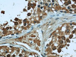 KHSRP Rabbit anti-Human, Mouse, Rat, Polyclonal, Proteintech:Antibodies:Primary