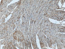 TMEM181 Rabbit anti-Human, Mouse, Polyclonal, Proteintech:Antibodies:Primary