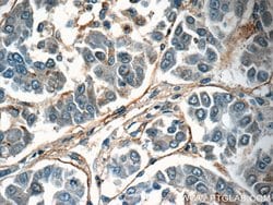 TMEM181 Rabbit anti-Human, Mouse, Polyclonal, Proteintech:Antibodies:Primary