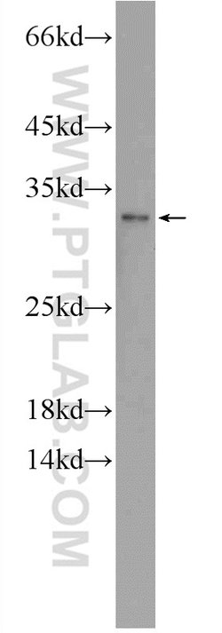 TSN Rabbit anti-Human, Mouse, Polyclonal, Proteintech:Antibodies:Primary