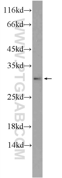 TSN Rabbit anti-Human, Mouse, Polyclonal, Proteintech:Antibodies:Primary