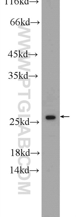 TSN Rabbit anti-Human, Mouse, Polyclonal, Proteintech:Antibodies:Primary