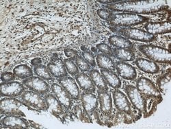 GATA5 Rabbit anti-Human, Mouse, Polyclonal, Proteintech 150 &mu;L; Unconjugated:Antibodies,
