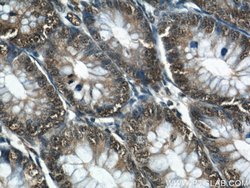 GATA5 Rabbit anti-Human, Mouse, Polyclonal, Proteintech 150 &mu;L; Unconjugated:Antibodies,