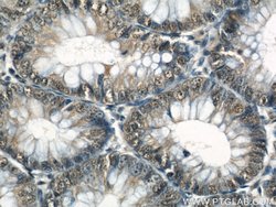 GATA5 Rabbit anti-Human, Mouse, Polyclonal, Proteintech 150 &mu;L; Unconjugated:Antibodies,