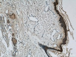 Loricrin Rabbit anti-Human, Mouse, Polyclonal, Proteintech 150 &mu;L | Buy Online | Proteintech Group Inc | Fisher Scientific