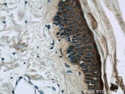 Loricrin Rabbit anti-Human, Mouse, Polyclonal, Proteintech 150 &mu;L | Buy Online | Proteintech Group Inc | Fisher Scientific