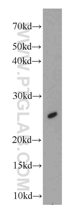 Loricrin Rabbit anti-Human, Mouse, Polyclonal, Proteintech 150 &mu;L | Buy Online | Proteintech Group Inc | Fisher Scientific