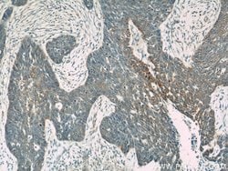 Loricrin Rabbit anti-Human, Mouse, Polyclonal, Proteintech 150 &mu;L | Buy Online | Proteintech Group Inc | Fisher Scientific