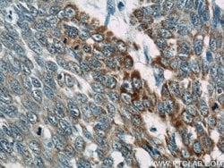 Loricrin Rabbit anti-Human, Mouse, Polyclonal, Proteintech 150 &mu;L | Buy Online | Proteintech Group Inc | Fisher Scientific