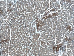 EXOC6B Rabbit anti-Human, Mouse, Polyclonal, Proteintech:Antibodies:Primary