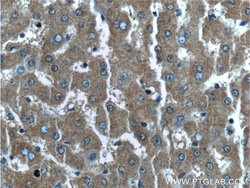 EXOC6B Rabbit anti-Human, Mouse, Polyclonal, Proteintech:Antibodies:Primary