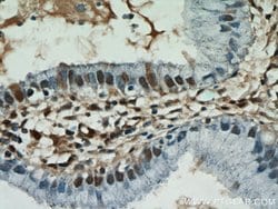 ESR2 Beta-3 Rabbit anti-Human, Polyclonal, Proteintech:Antibodies:Primary
