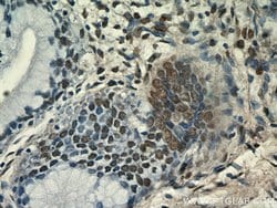 ESR2 Beta-3 Rabbit anti-Human, Polyclonal, Proteintech:Antibodies:Primary