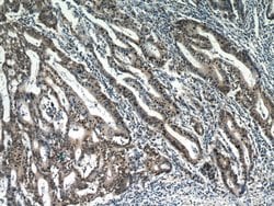 ESR2 Beta-3 Rabbit anti-Human, Polyclonal, Proteintech:Antibodies:Primary