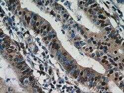 ESR2 Beta-3 Rabbit anti-Human, Polyclonal, Proteintech:Antibodies:Primary
