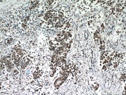 ESR2 Beta-3 Rabbit anti-Human, Polyclonal, Proteintech:Antibodies:Primary