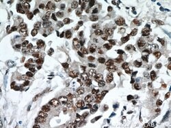 ESR2 Beta-3 Rabbit anti-Human, Polyclonal, Proteintech:Antibodies:Primary