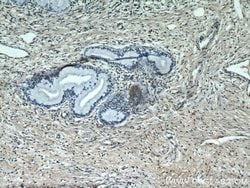 ESR2 Beta-3 Rabbit anti-Human, Polyclonal, Proteintech:Antibodies:Primary