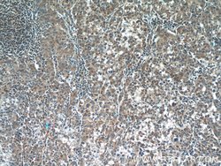 TPM3 Rabbit anti-Human, Mouse, Polyclonal, Proteintech 150 &mu;L; Unconjugated:Antibodies,