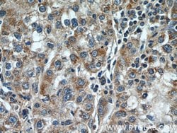 TPM3 Rabbit anti-Human, Mouse, Polyclonal, Proteintech 150 &mu;L; Unconjugated:Antibodies,