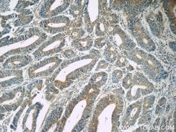 TPM3 Rabbit anti-Human, Mouse, Polyclonal, Proteintech 150 &mu;L; Unconjugated:Antibodies,