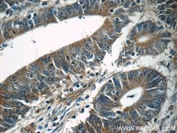 TPM3 Rabbit anti-Human, Mouse, Polyclonal, Proteintech 150 &mu;L; Unconjugated:Antibodies,