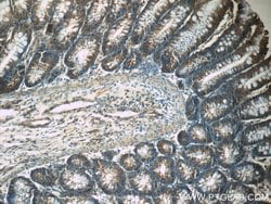 TPM3 Rabbit anti-Human, Mouse, Polyclonal, Proteintech 150 &mu;L; Unconjugated:Antibodies,