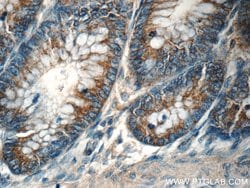 TPM3 Rabbit anti-Human, Mouse, Polyclonal, Proteintech 150 &mu;L; Unconjugated:Antibodies,
