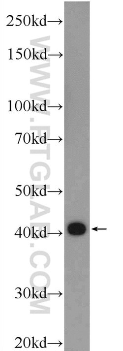 TPM3 Rabbit anti-Human, Mouse, Polyclonal, Proteintech 150 &mu;L; Unconjugated:Antibodies,