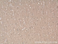 AHSA2 Rabbit anti-Human, Mouse, Polyclonal, Proteintech 150 &mu;L; Unconjugated:Antibodies,