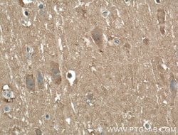 AHSA2 Rabbit anti-Human, Mouse, Polyclonal, Proteintech 150 &mu;L; Unconjugated:Antibodies,