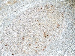 CLEC9A Rabbit anti-Human, Polyclonal, Proteintech:Antibodies:Primary Antibodies