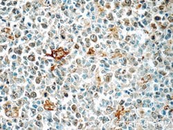 CLEC9A Rabbit anti-Human, Polyclonal, Proteintech:Antibodies:Primary Antibodies