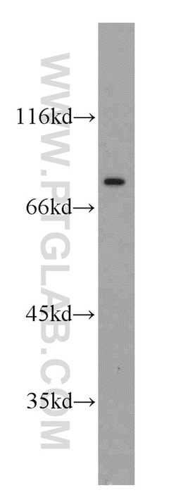 NUP88 Rabbit anti-Human, Polyclonal, Proteintech 150 &mu;L; Unconjugated:Antibodies,