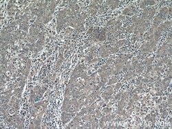 MMP20 Rabbit anti-Human, Mouse, Rat, Polyclonal, Proteintech:Antibodies:Primary