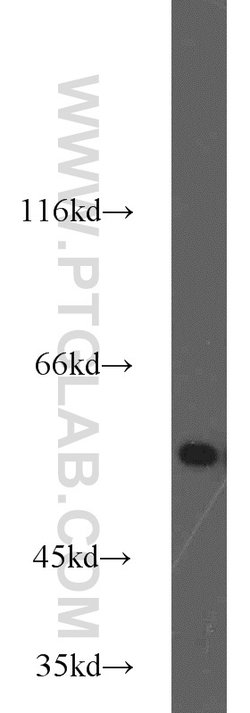 MMP20 Rabbit anti-Human, Mouse, Rat, Polyclonal, Proteintech:Antibodies:Primary