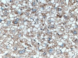 Serpina3k Rabbit anti-Mouse, Polyclonal, Proteintech 150 &mu;L; Unconjugated:Antibodies,