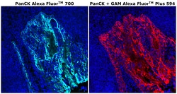 Invitrogen&trade;&nbsp;Pan Cytokeratin Monoclonal Antibody (AE1/AE3), Alexa Fluor&trade; 700