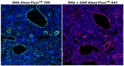 Invitrogen™ Alpha-Smooth Muscle Actin Monoclonal Antibody (1A4), Alexa Fluor™ 700