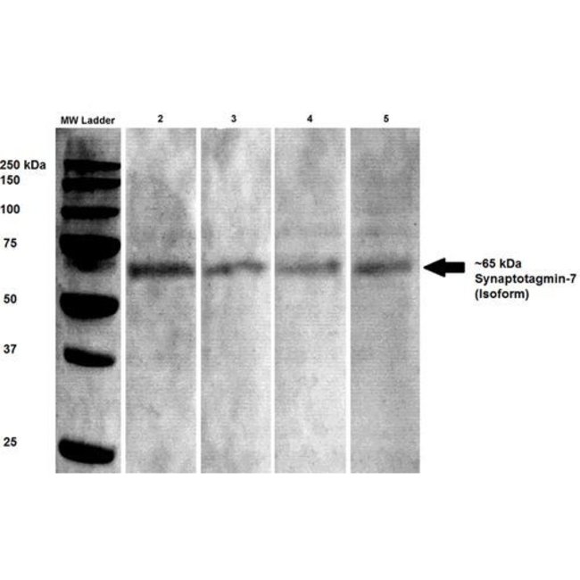Synaptotagmin7 Monoclonal Antibody (S27514), QED Bioscience 100 μg; Fisher Scientific