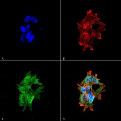 LRRK2/Dardarin Monoclonal Antibody (S138-6), QED Bioscience 100 &mu;g | Buy Online | Leinco Technologies Inc | Fisher Scientific