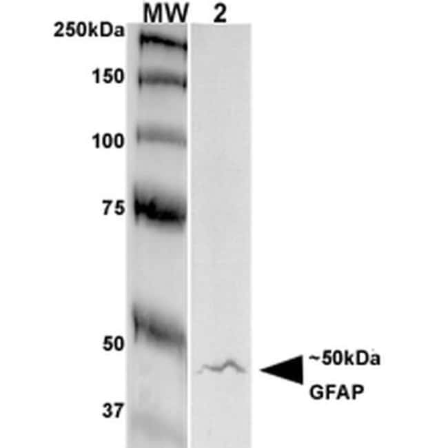 GFAP Monoclonal Antibody (S206A8), QED Bioscience 100 μg; UnconjugatedAntibodies, Fisher