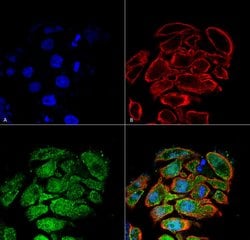 Glucose transporter 2 Polyclonal Antibody, QED Bioscience 100 &mu;g; Unconjugated:Antibodies,